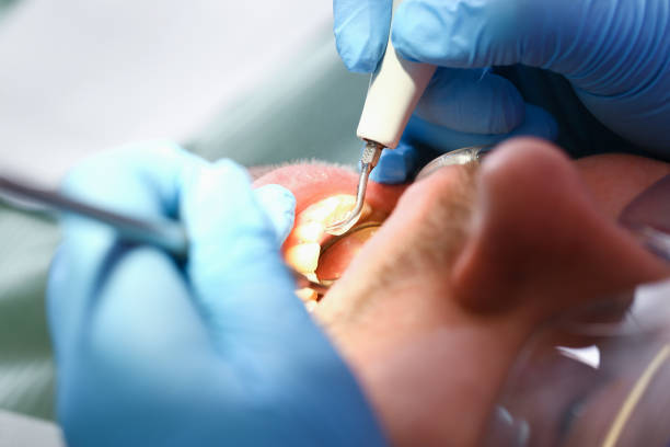 Best Emergency Dental Care for Abscessed Tooth in Chrisman, IL