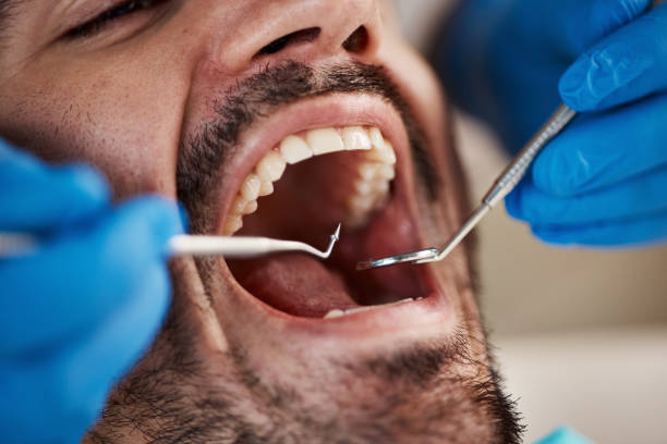 Best 24-Hour Emergency Dentist in Chrisman, IL