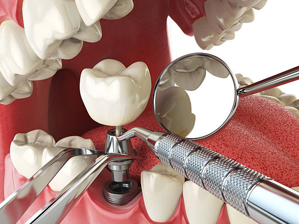 Best Urgent Dental Care for Toothache in Chrisman, IL