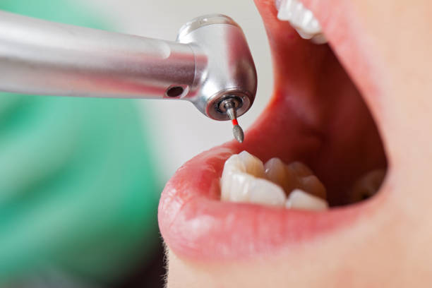 Best Mobile Emergency Dentist in Chrisman, IL